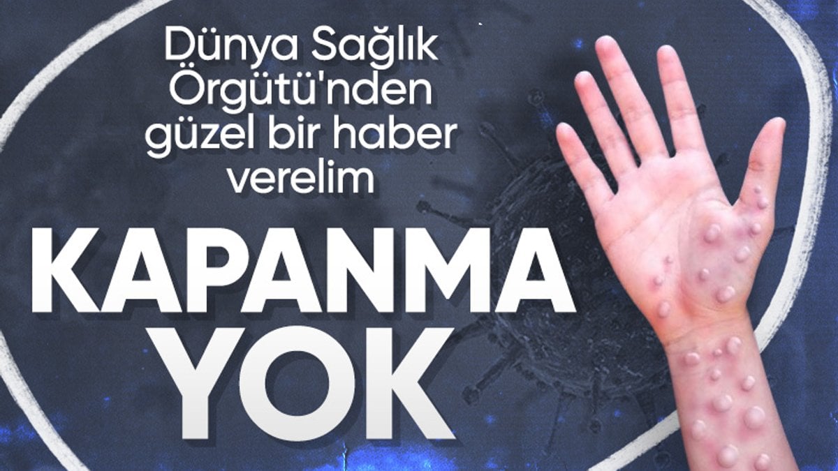 DSÖ: Maymun çiçeği virüsü nedeniyle bir kapanmaya ihtiyaç yok